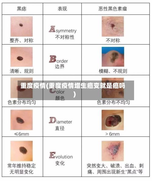 重度疫情(重度疫情增生癌变就是癌吗)-第2张图片
